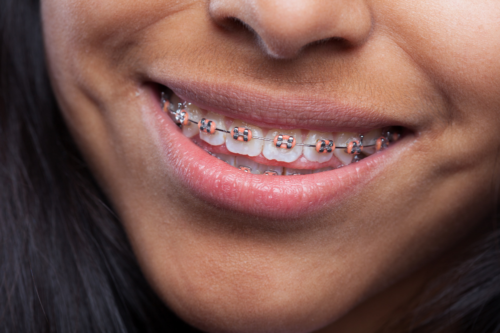 about our orthodontic office  Visalia, CA