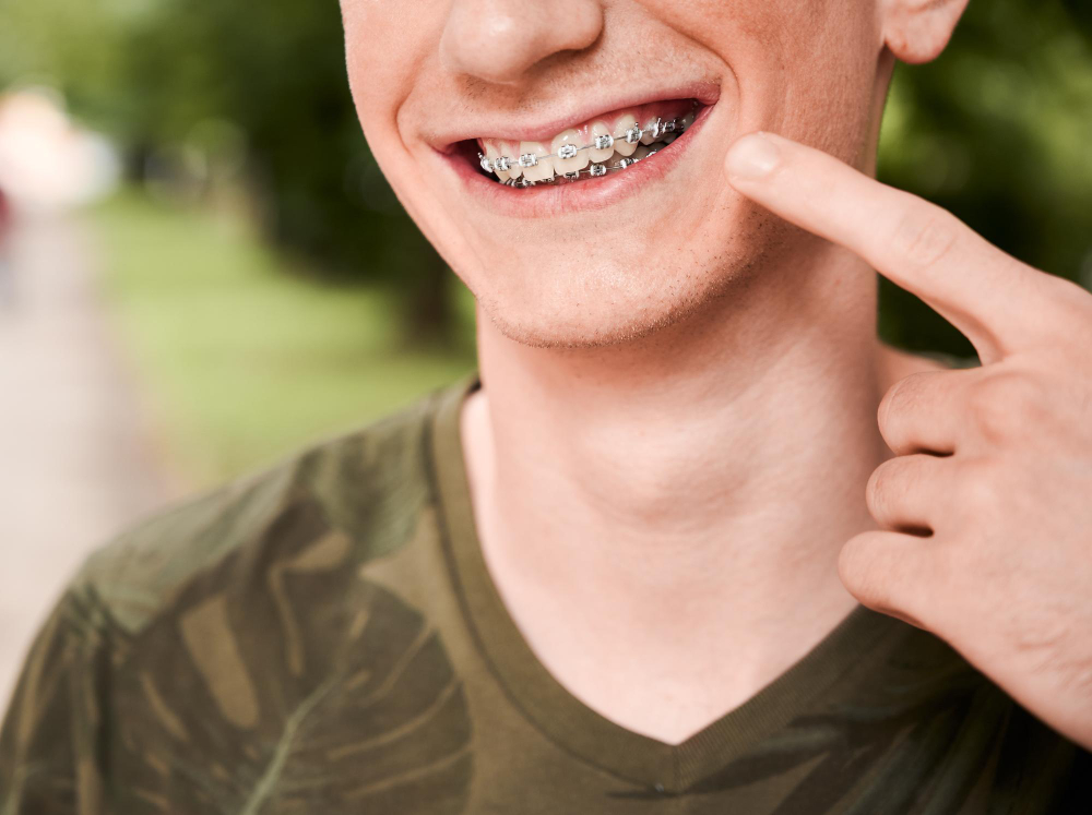 braces for teens Visalia, CA