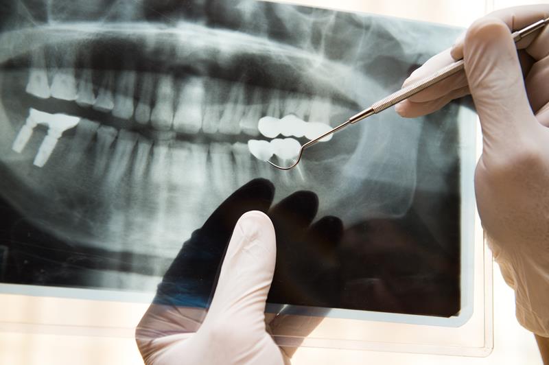 Digital X-Rays and 3D CT Scanning