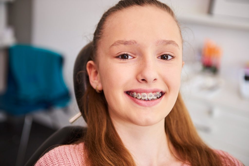 Early Orthodontic Treatments